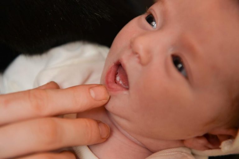 Bebê já nasce com dentinhos? Dentes Natais e Dentes Neonatais, entenda.